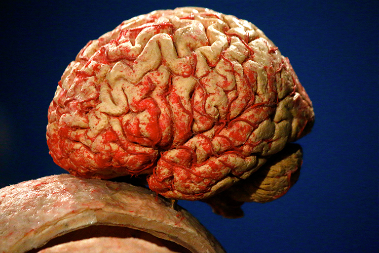 Curso de capacitação em Neuroanatomia